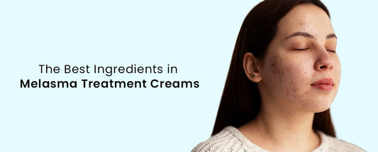 Best Ingredients in Melasma Treatment Creams