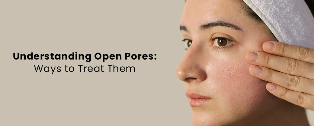 Understanding Open Pores: Ways to Treat Them