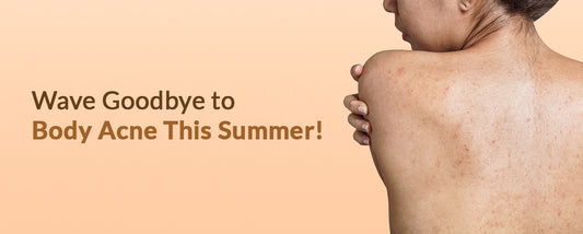 Wave Goodbye to Body Acne This Summer!