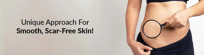 Explore Fixderma's Scars and Stretch Mark Treatment Products