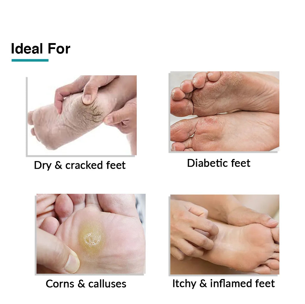 Dr. Foot Cracked Heel Moisturizer Foot Cream Skincare Lotion. Moisturizing  Skin Care Lotion W/Shea Butter & Lactic Acid Helps Heal Cracked Heels, Dry  Skin On Feet, & Soften Calluses, Large 8 Fl