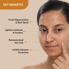 2% Kojic Acid + 1% Arbutin, Skarfix-Plus Scar Removal Cream, Hyperpigmentation and Melasma Treatment