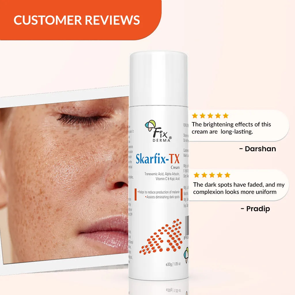 Why people prefer Skarfix TX cream for Melasma